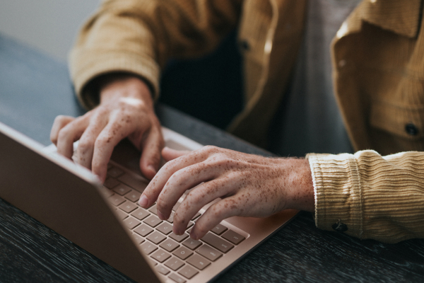 What Is a USB Attack and How to Prevent It